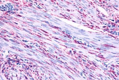 alpha-1b Adrenergic Receptor Antibody in Immunohistochemistry (Paraffin) (IHC (P))