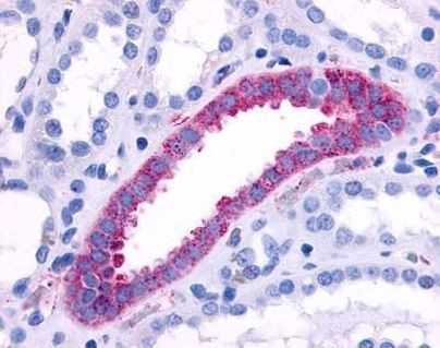 alpha-1b Adrenergic Receptor Antibody in Immunohistochemistry (IHC)