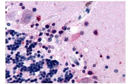 MTNR1B Antibody in Immunohistochemistry (Paraffin) (IHC (P))