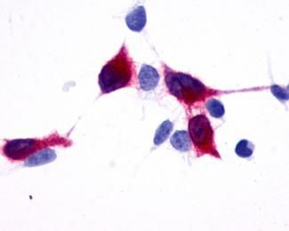 TPRA1 Antibody in Immunocytochemistry (ICC/IF)