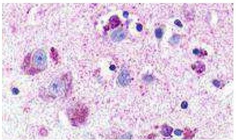 NMUR1 Antibody in Immunohistochemistry (Paraffin) (IHC (P))