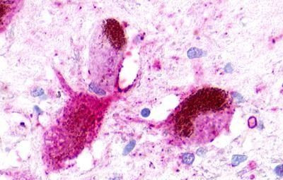 NMUR1 Antibody in Immunohistochemistry (Paraffin) (IHC (P))