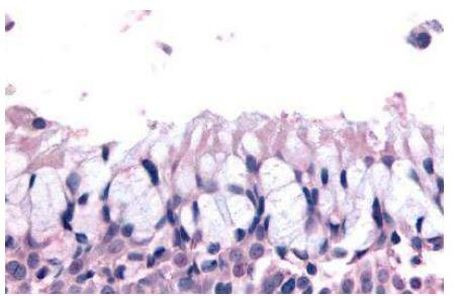 LS189744 Antibody in Immunohistochemistry (Paraffin) (IHC (P))