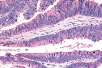 FZD7 Antibody in Immunohistochemistry (Paraffin) (IHC (P))