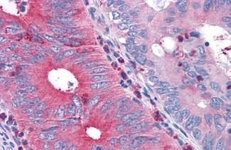 TAS1R1 Antibody in Immunohistochemistry (Paraffin) (IHC (P))