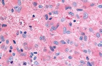 GHSR Antibody in Immunohistochemistry (Paraffin) (IHC (P))