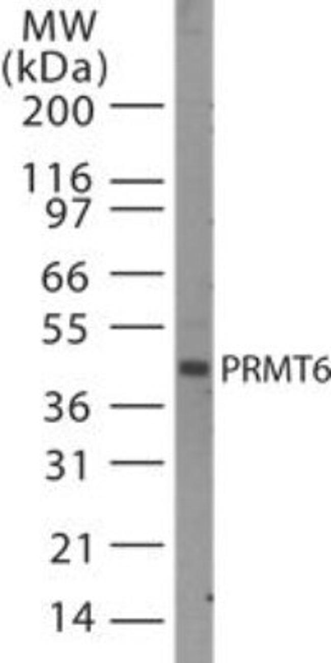 PRMT6 Antibody in Western Blot (WB)