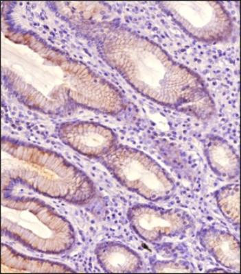 TAK1 Antibody in Immunohistochemistry (Paraffin) (IHC (P))