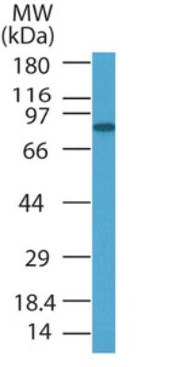 PRDM5 Antibody in Western Blot (WB)