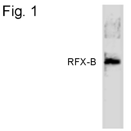 RFXANK Antibody in Western Blot (WB)