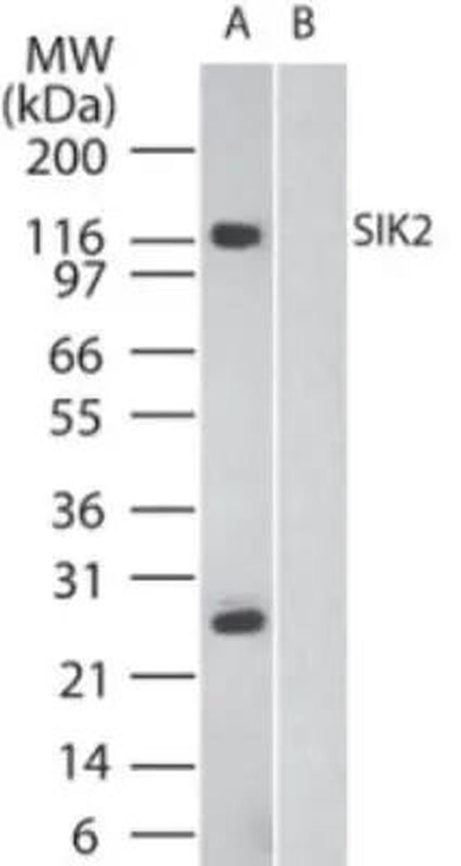 SIK2 Antibody in Western Blot (WB)