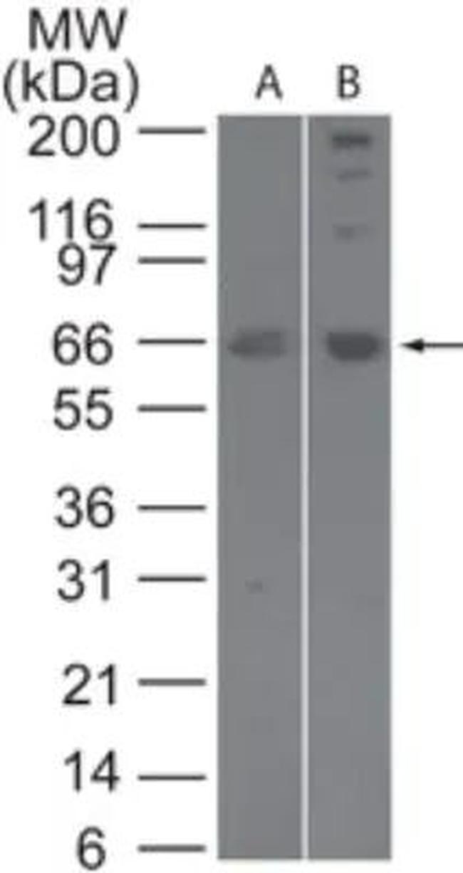 SENP2 Antibody in Western Blot (WB)