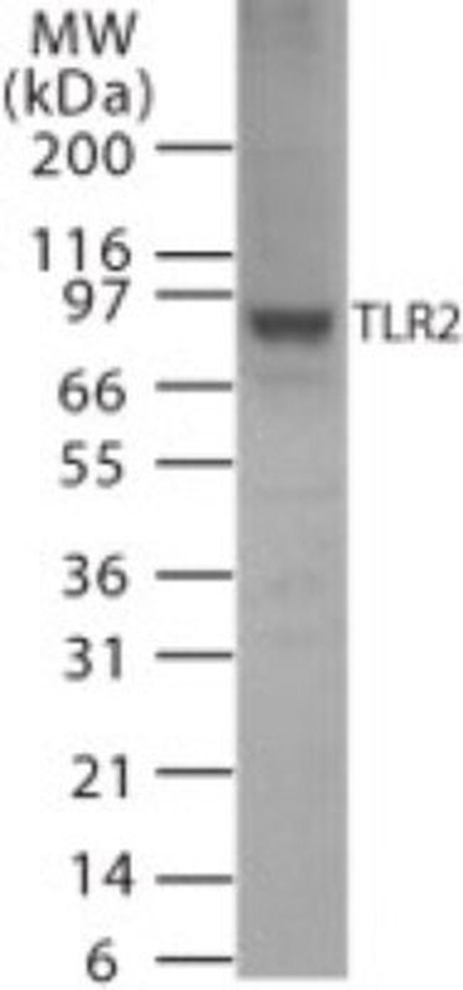 TLR2 Antibody in Western Blot (WB)