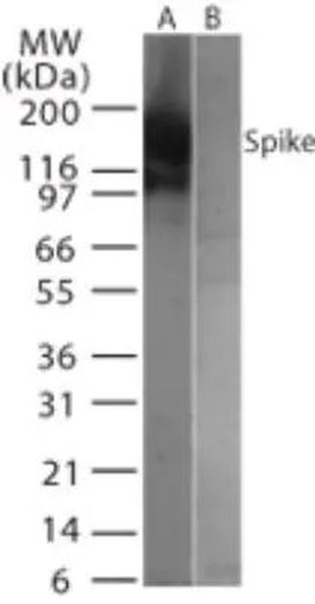 SARS Coronavirus Spike Protein Antibody in Western Blot (WB)