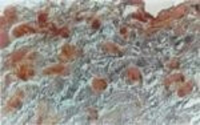 NIFK Antibody in Immunohistochemistry (Frozen) (IHC (F))