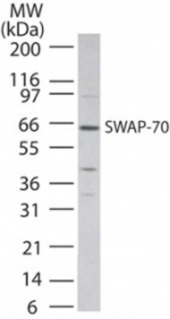 SWAP70 Antibody in Western Blot (WB)