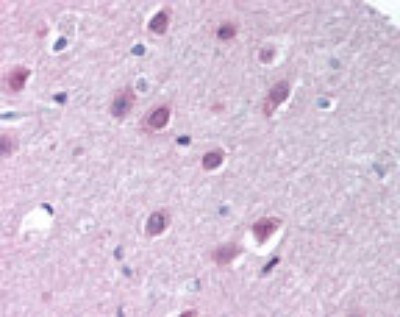 Importin 9 Antibody in Immunohistochemistry (Paraffin) (IHC (P))