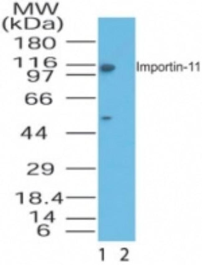 Importin 11 Antibody in Western Blot (WB)