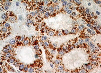 XPO4 Antibody in Immunohistochemistry (Paraffin) (IHC (P))