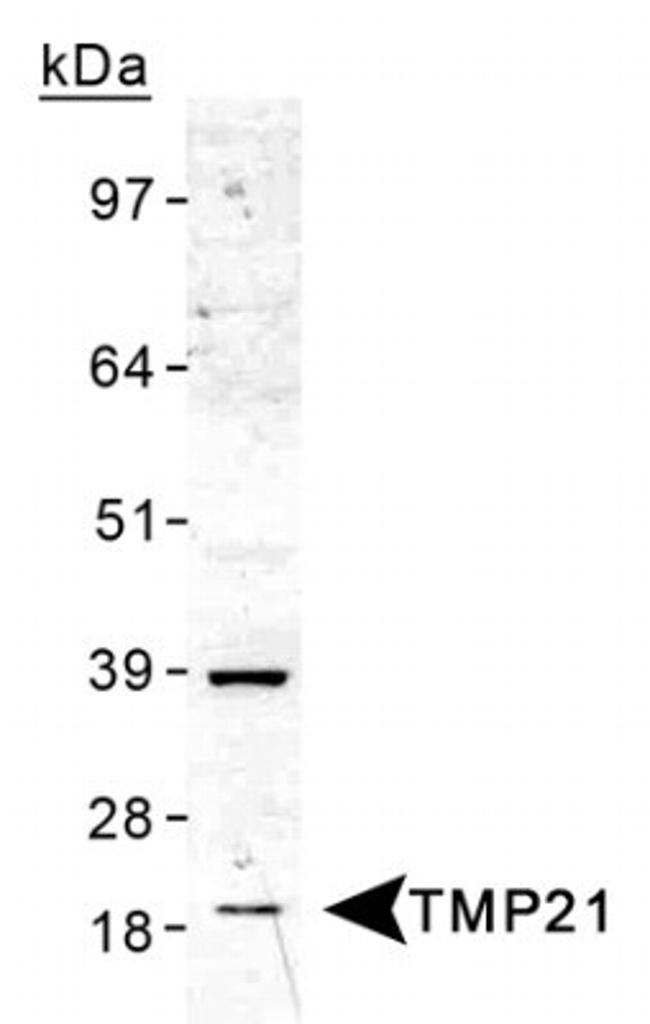 TMP21 Antibody in Western Blot (WB)