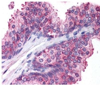 Spectrin beta-3 Antibody in Immunohistochemistry (Paraffin) (IHC (P))