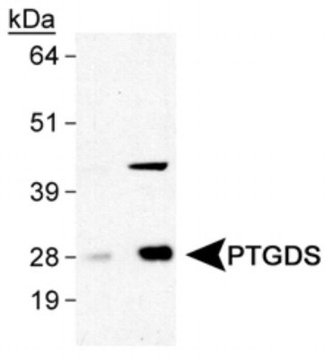 PTGDS Antibody in Western Blot (WB)