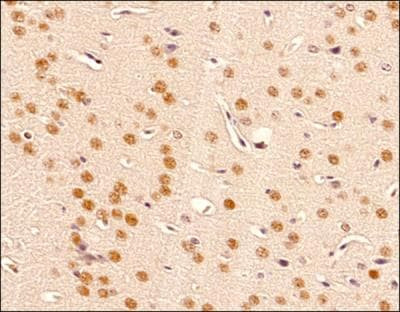 BMAL1 Antibody in Immunohistochemistry (Paraffin) (IHC (P))