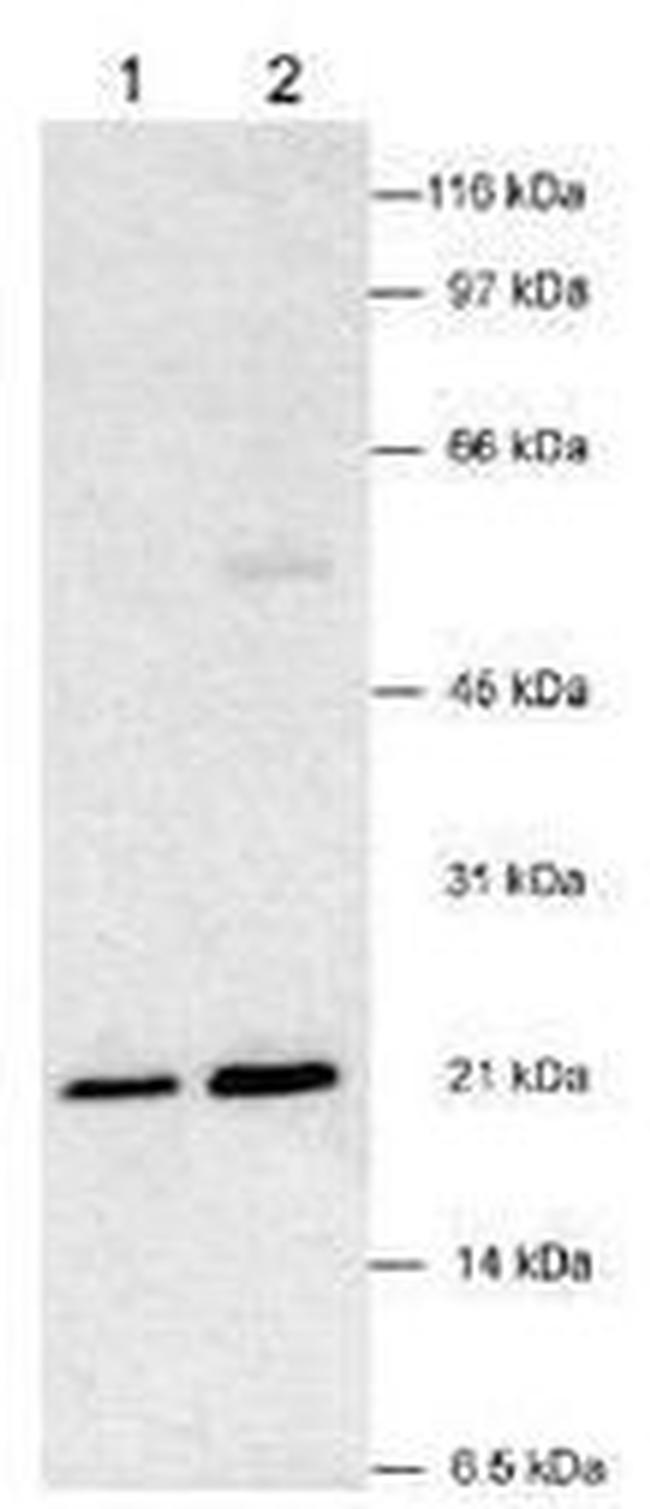 VHL Antibody in Western Blot (WB)