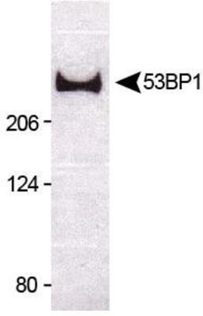 53BP1 Antibody in Western Blot (WB)