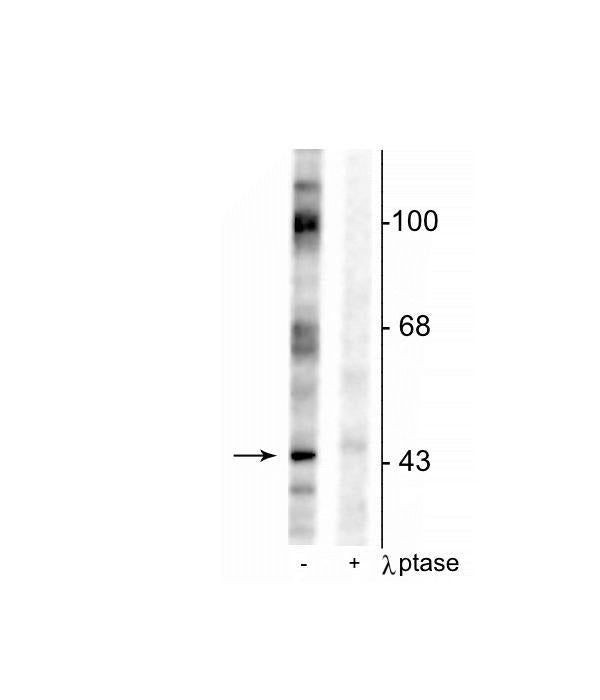 Phospho-EphB2 (Tyr317) Antibody in Western Blot (WB)