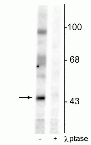 Phospho-EphB2 (Tyr331) Antibody in Western Blot (WB)