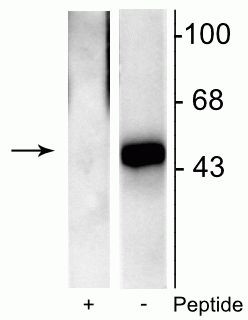 Phospho-ELK1 (Ser383) Antibody in Western Blot (WB)