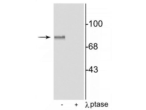 Phospho-MARCKS (Ser152, Ser156) Antibody in Western Blot (WB)