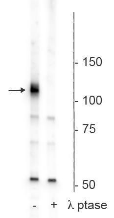 Phospho-PLK1 (Ser482, Ser486, Ser490) Antibody in Western Blot (WB)