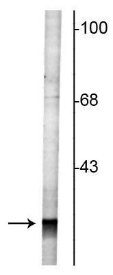 RAB3a Antibody in Western Blot (WB)