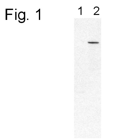 PDE6B Antibody in Western Blot (WB)