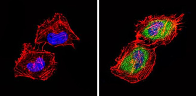 TPH1 Antibody in Immunocytochemistry (ICC/IF)