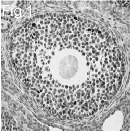 FOXL2 Antibody in Immunohistochemistry (IHC)