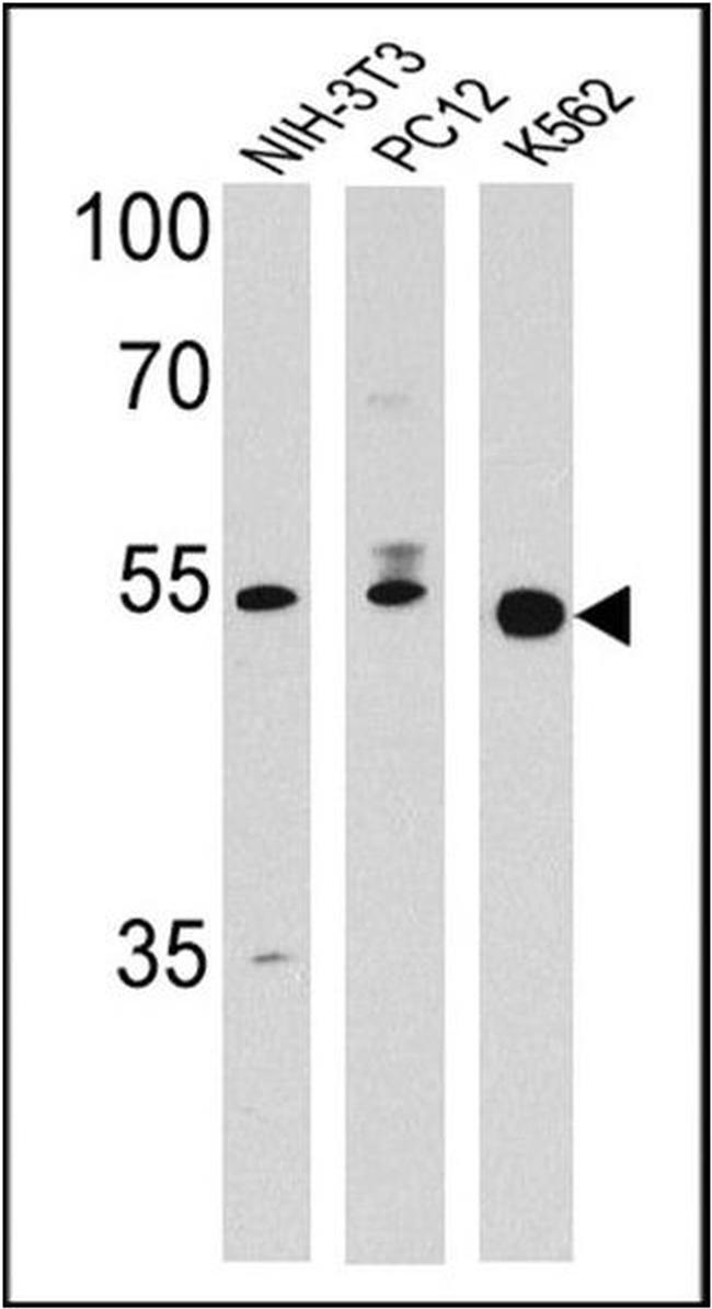 PPAR delta Antibody in Western Blot (WB)