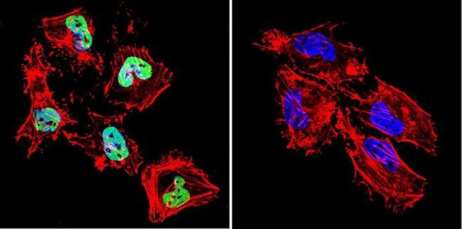 HDAC1 Antibody in Immunocytochemistry (ICC/IF)