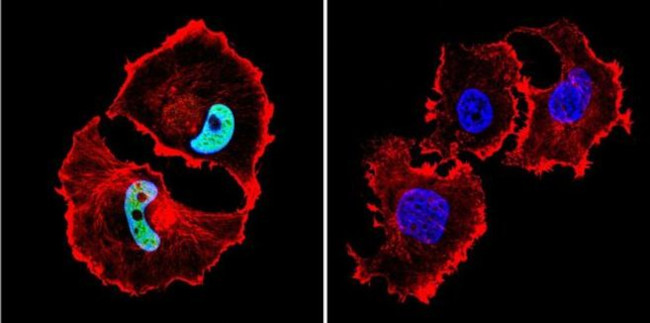 HDAC1 Antibody in Immunocytochemistry (ICC/IF)