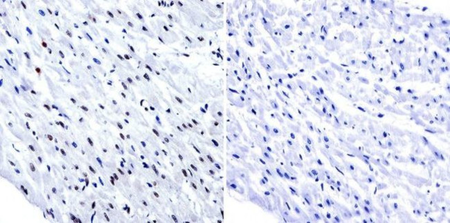 HDAC1 Antibody in Immunohistochemistry (Paraffin) (IHC (P))