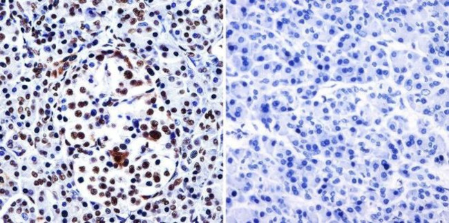 HDAC1 Antibody in Immunohistochemistry (Paraffin) (IHC (P))