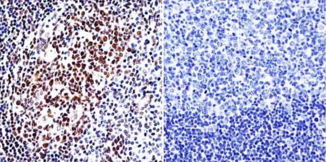 HDAC1 Antibody in Immunohistochemistry (Paraffin) (IHC (P))