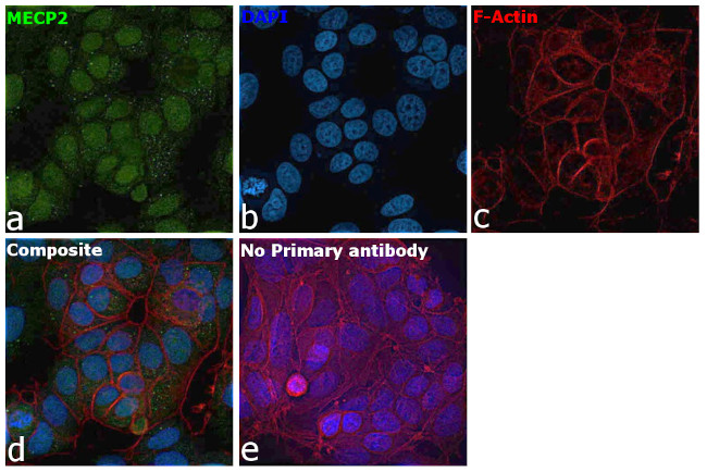 MECP2 Antibody in Immunocytochemistry (ICC/IF)