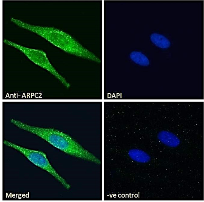 ARPC2 Antibody in Immunocytochemistry (ICC/IF)