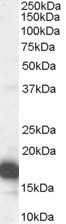 p16INK4a Antibody in Western Blot (WB)