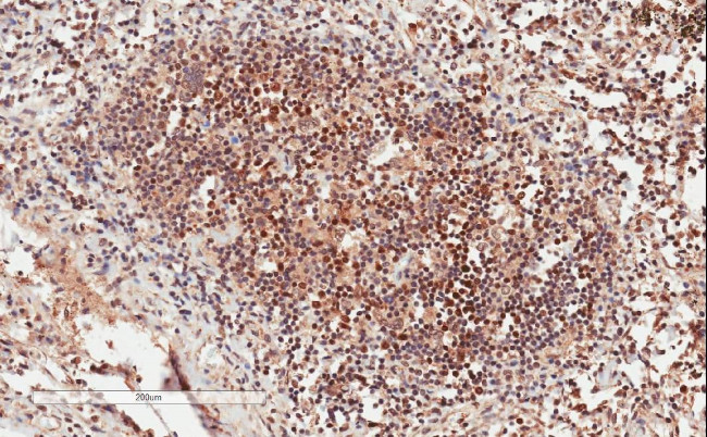 GRB2 Antibody in Immunohistochemistry (Paraffin) (IHC (P))