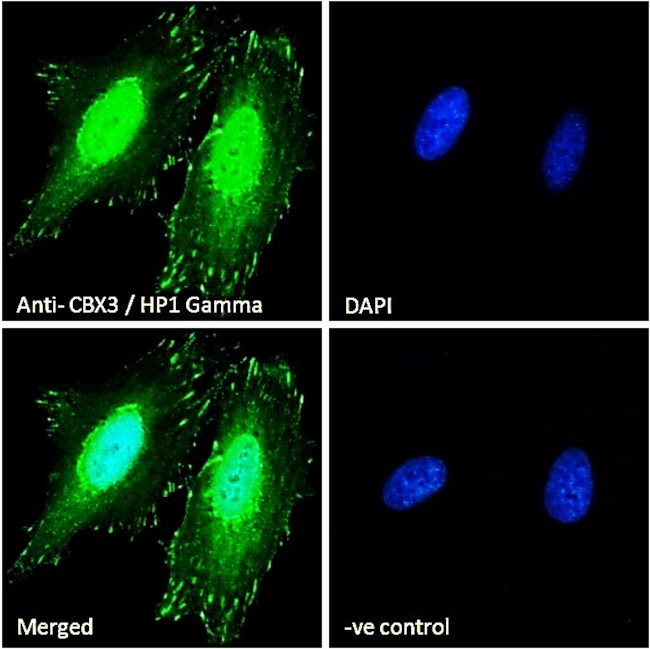 HP1 gamma Antibody in Immunocytochemistry (ICC/IF)