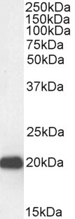 HP1 gamma Antibody in Western Blot (WB)